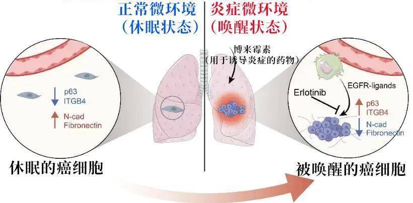 长期炎症会“唤醒”癌细胞<strong></p>
<p>XRP行情</strong>！这份抗炎指南每个人都该看看