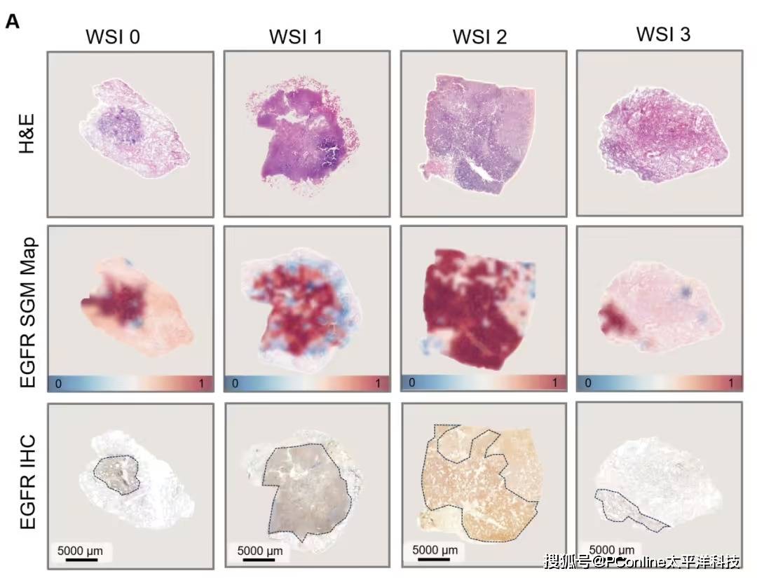 准确率高达 99%<strong></p>
<p>币安币行情</strong>！腾讯 AI 可预测肺癌基因突变