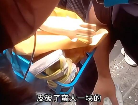 看着都疼<strong></p>
<p>艾达币行情</strong>！上海街头一男子突然求助：10岁女儿被死死卡住！这个行为太危险→
