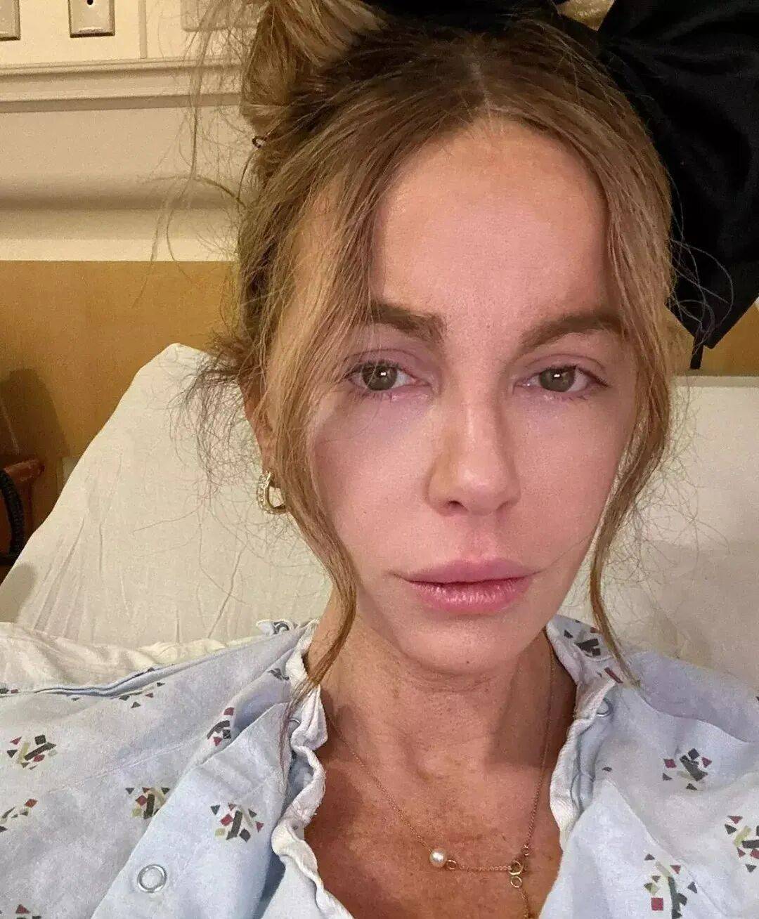 最美吸血鬼如今瘦成骷髅<strong></p>
<p>ETH价格</strong>？《珍珠港》女主究竟怎么了？