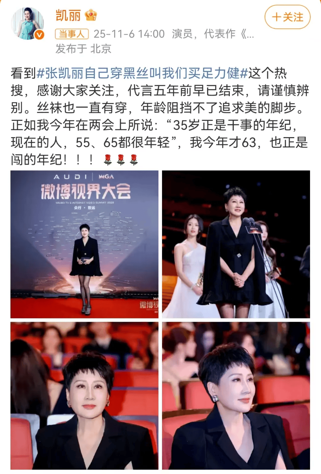 63岁女演员张凯丽晒照<strong></p>
<p>IPFS价格</strong>，黑丝袜配高跟鞋，曾表示：年龄阻挡不了追求美的脚步