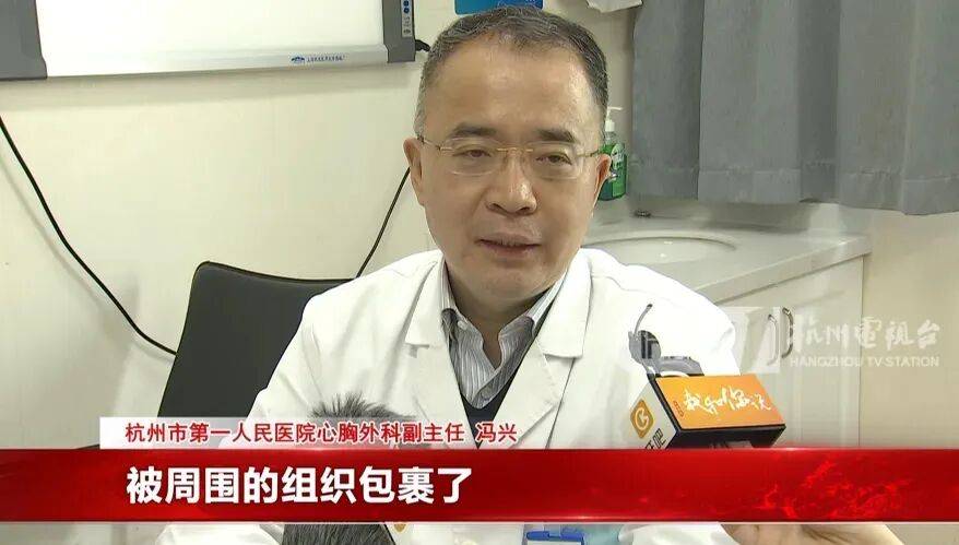 17岁小伙参军体检发现胸腔内有根5cm缝衣针<strong></p>
<p>虚拟货币ico</strong>,父母回忆或是1岁时扎入,取出时已锈迹斑斑